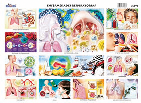 M797 Enfermedades respiratorias (25 pzas)