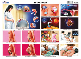 M182 Embarazo (25 pzas)